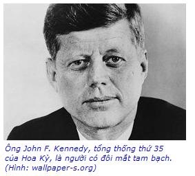 Tổng thống John Kennedy chết yểu do tướng xấu